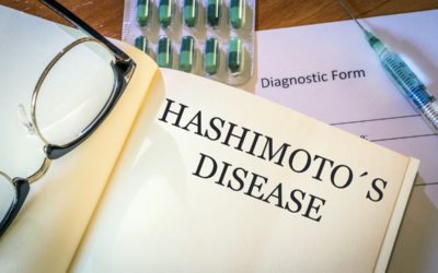 Hashimoto disease diagnosis and treatment