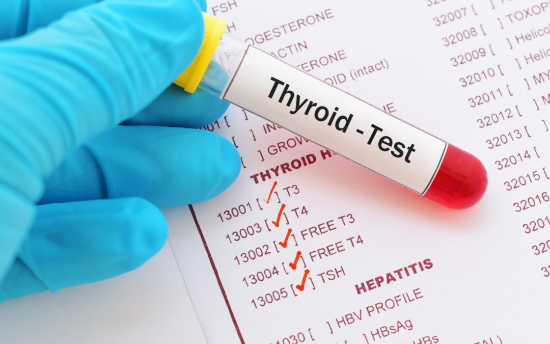 Thyroid blood test: understanding the key indicators of a healthy thyroid